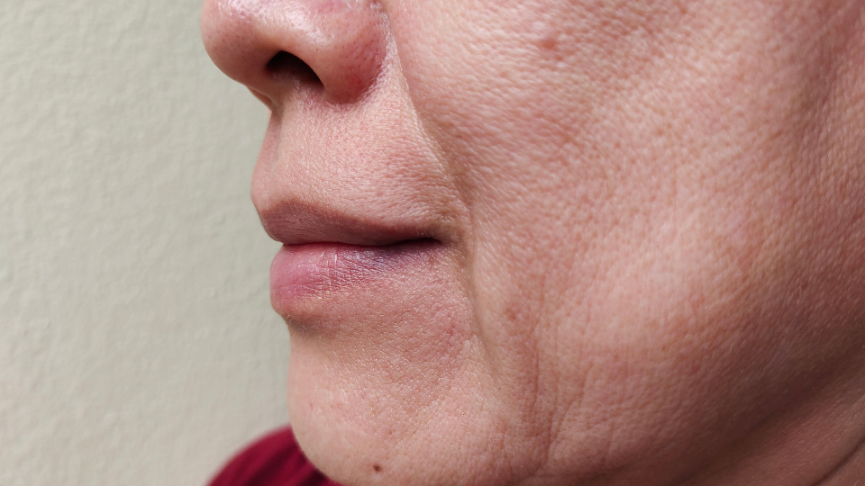 Close-up view of a woman's lower face showing lips and chin area with visible skin texture.