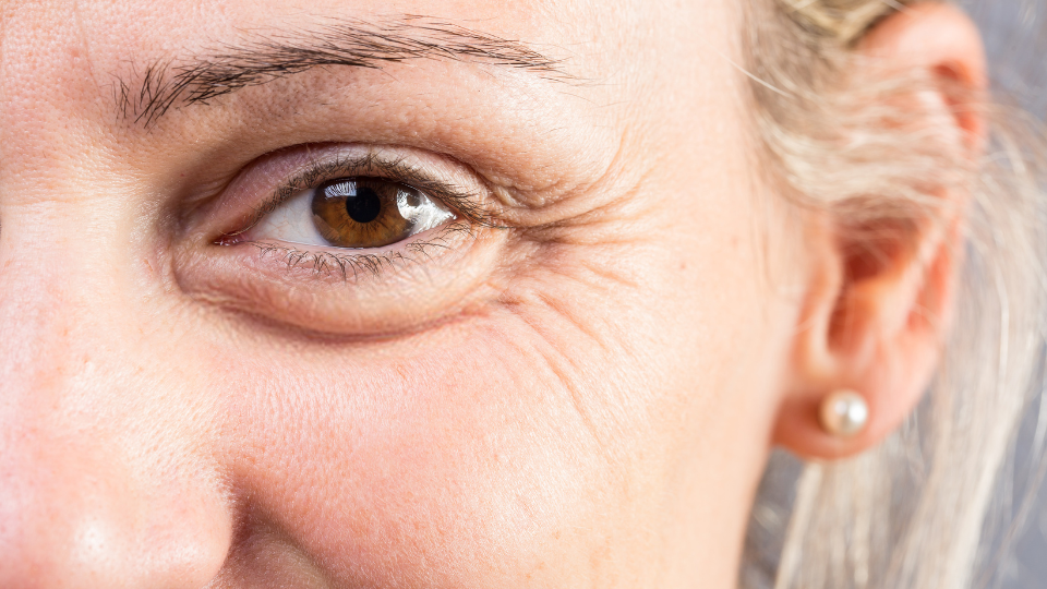 Close-up of a brown eye with crow’s feet wrinkles at the outer corner, highlighting fine lines around the eye area and natural skin texture.
