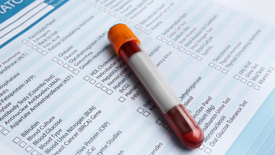 Blood test sample tube placed on a laboratory evaluation form with checkboxes.